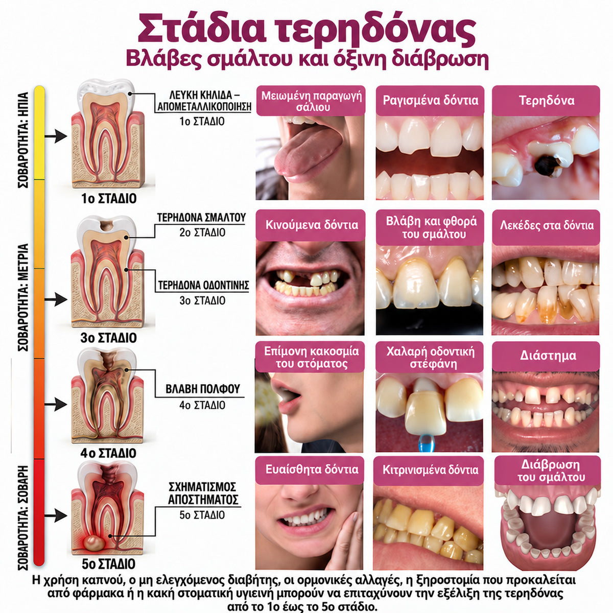 🧚‍♀️☘️🦷HEATWOLF® DenPerm – Φυσική γέλη πλήρωσης σμάλτου για την αποκατάσταση της τερηδόνας