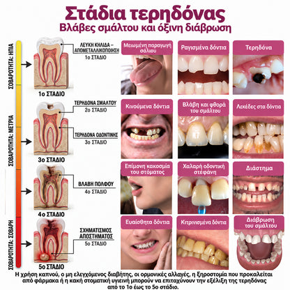 🧚‍♀️☘️🦷HEATWOLF® DenPerm – Φυσική γέλη πλήρωσης σμάλτου για την αποκατάσταση της τερηδόνας