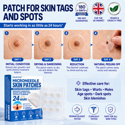 40%off | Healrize® 🌿 Microneedles for Flawless Skin – Self-Adhesive Wart Remover