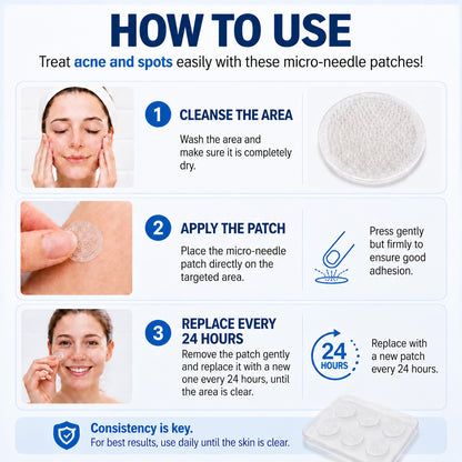 40%off | Healrize® 🌿 Microneedles for Flawless Skin – Self-Adhesive Wart Remover